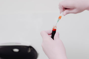 The B12 Blood Test: What It Actually Measures and Why the Numbers Can Fool You